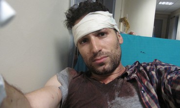 Gil Shefler after being attacked by Greek mob