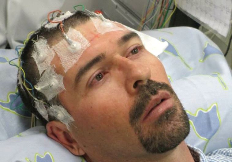  Electrodes connected to an EEG help to track seizures caused by a brain tumor that is an inoperable cancer (photo credit: GAL SELA)