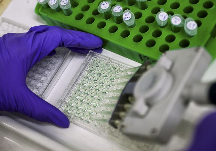 A scientist prepares protein samples for analysis in a lab 