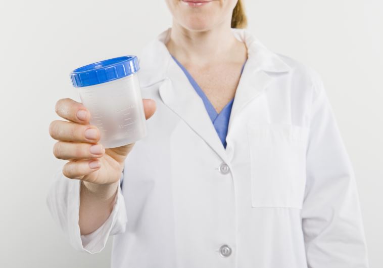 Urine sample