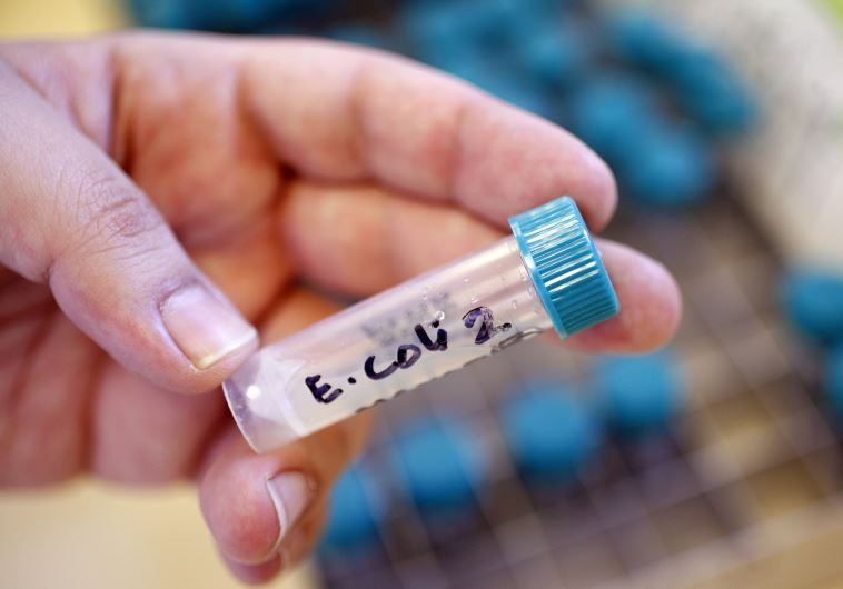 A sample bottle containing E. coli bacteria is seen at the Health Protection Agency in north London