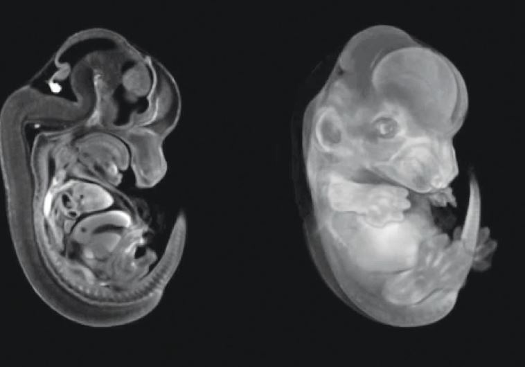 WEIZMANN INSTITUTE scientists have studied the effect of cytomegalovirus on mouse fetuses. 