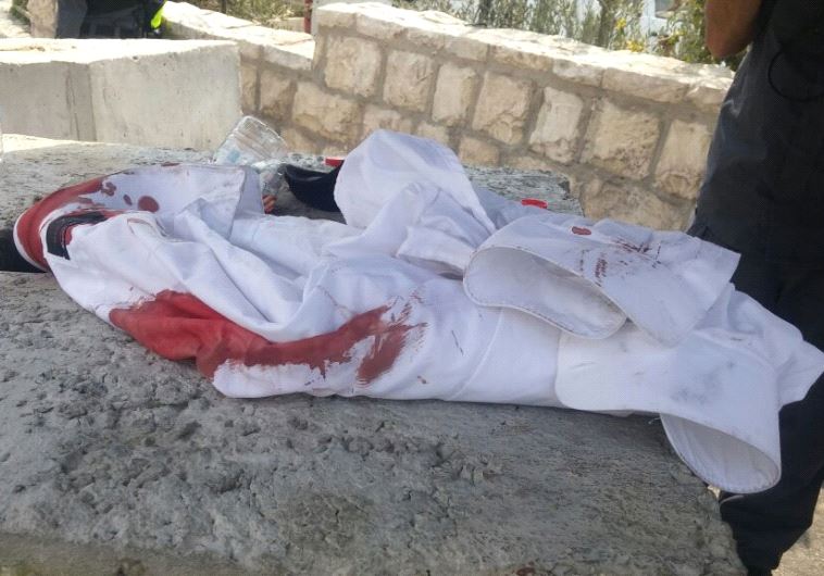 blood stains from stabbing