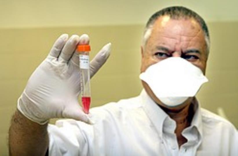Dr. Arkadi Ozerny with swine flu test kit. (photo credit: Ariel Jerozolimksi)