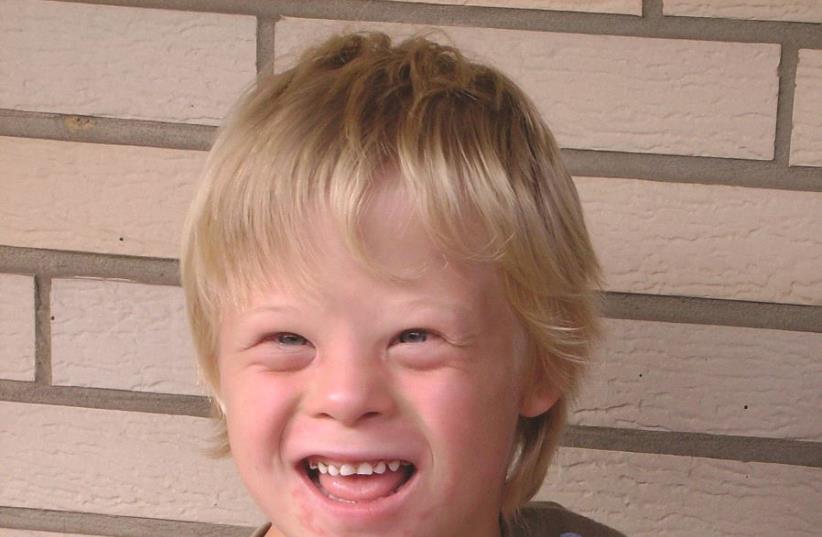 Un enfant atteint du syndrome de Down (photo credit: PIXABAY)