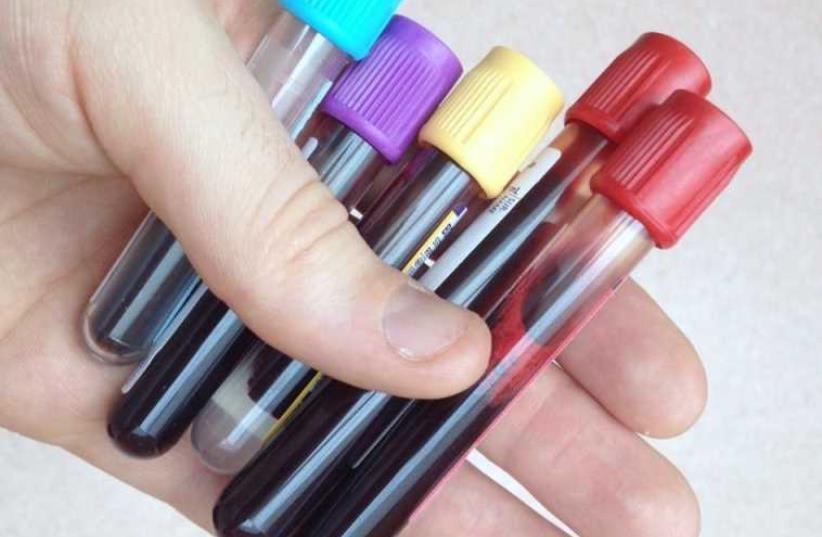 Vacutainer blood bottles (photo credit: Wikimedia Commons)