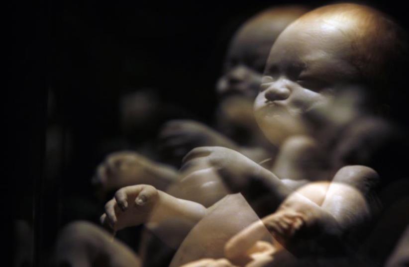 A plastinated fetus is seen during the exhibition "Body Worlds" by Gunther von Hagen in Rome (photo credit: REUTERS)
