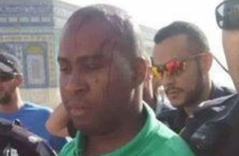 Tourist attacked at Temple Mount (photo credit: ARAB MEDIA)