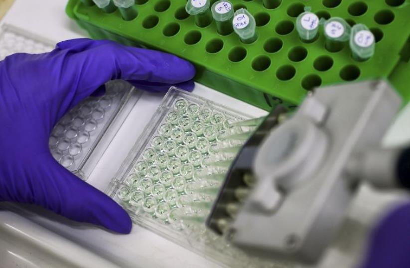 A scientist prepares protein samples for analysis in a lab at the Institute of Cancer Research in Sutton (photo credit: REUTERS)