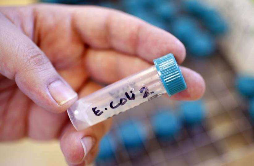 A sample bottle containing E. coli bacteria is seen at the Health Protection Agency in north London (photo credit: REUTERS)