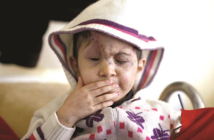 Five-year-old Sheima lost both eyes when hit by a stray bullet in Syria, February 9. (photo credit: REUTERS)
