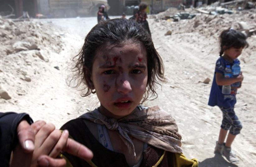  A wounded displaced Iraqi girl who fled from clashes is seen in the Old City of Mosul (photo credit: REUTERS)