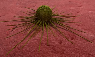 cancer cell - Photo By Thinkstock/Imagebank