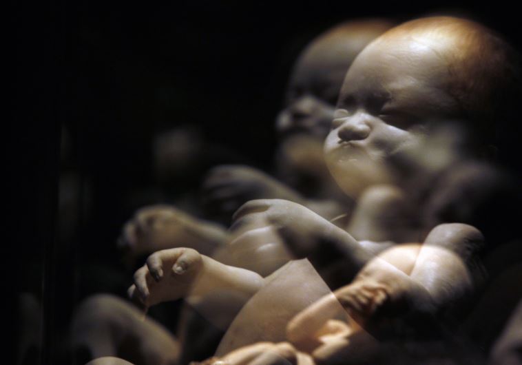 A plastinated fetus is seen during the exhibition ''Body Worlds'' by Gunther von Hagen in Rome (credit: REUTERS)