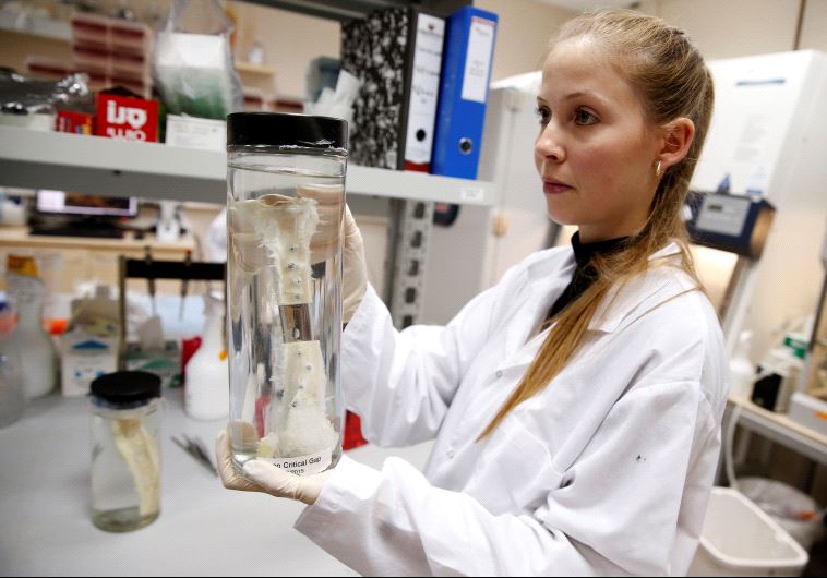 A researcher holds a vial containing a lab-grown, semi-liquid bone graft at the laboratory of Israeli biotech firm Bonus Biogroup in Haifa, Israel December 4, 2016 (credit: REUTERS)
