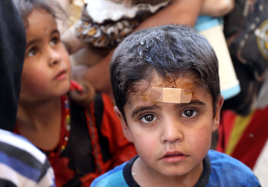 An injured displaced Iraqi child is seen after escaping from Mosul's Old City. (Credit: Reuters/Marius Bosch)