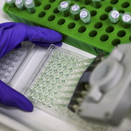 A scientist prepares protein samples for analysis in a lab at the Institute of Cancer Research in Sutton