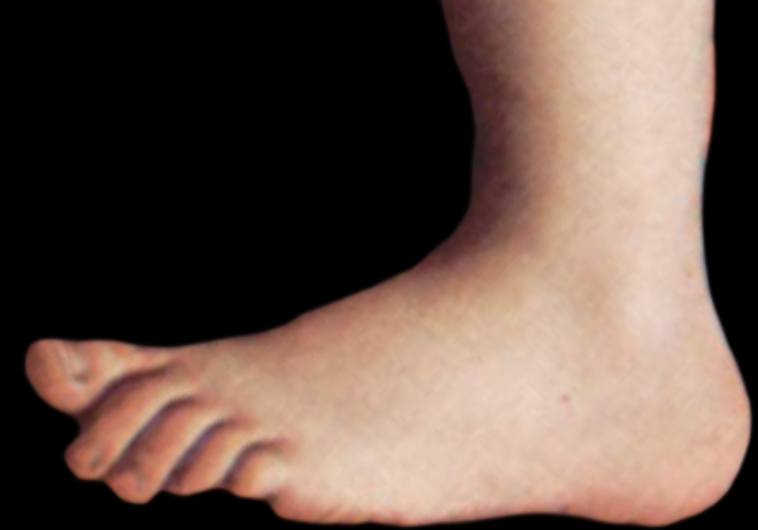 Cupid's foot, as used by Monty Python's Flying Circus