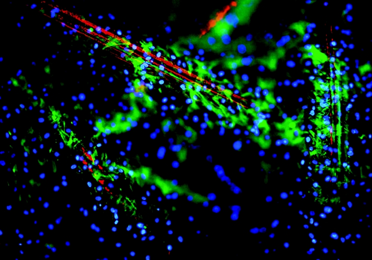 Cellules souches humaines